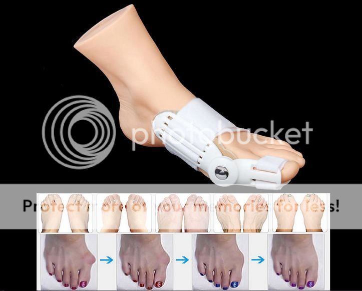 photo Splint 4_zpsqngpwshq.jpg